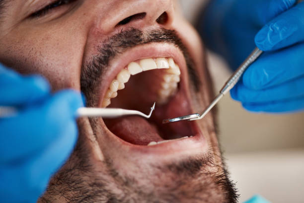Best Pediatric Emergency Dentist in Monroe, IA